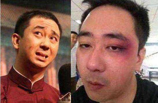 被妻子家暴的4位男星, 王自健人财两空, 他被烫6个烟头扇500耳光