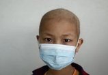 白血病易盯上小孩,6种白血病早期症状千万要警惕!