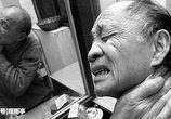 退休医生珍藏颈椎病验方公开!不到2元的成本,治一个好一个
