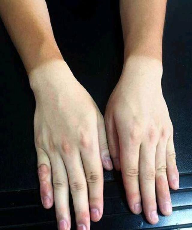 把食盐和白醋泡在一起太厉害了，解决了女人们的苦恼，效果太神奇