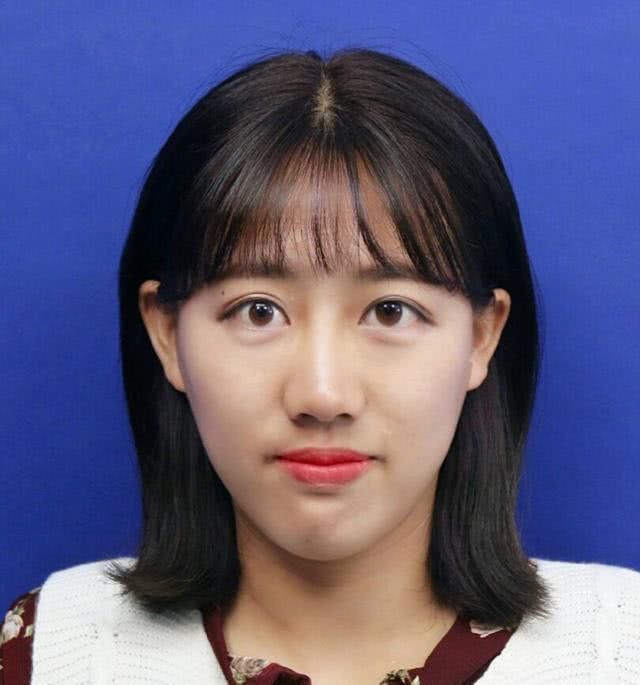 【调整】女生整容会被嫌弃吗只要没有这几点,整过之后还是很漂亮