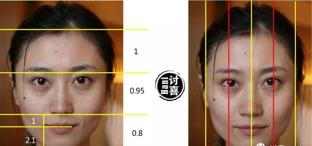  「衰老问题」素人整形分析 | 做对这些，宽方脸比瓜子脸更有优势