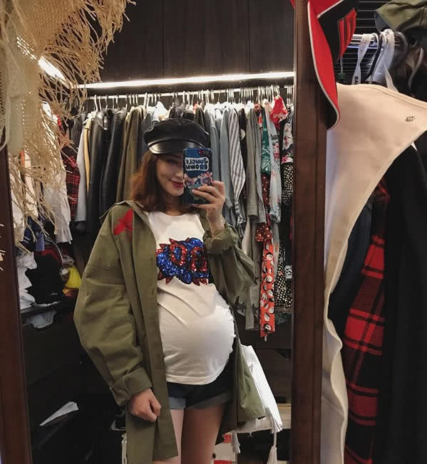 欧弟妻子孕中晒巨肚 自嘲:这惊人血管和黑色素