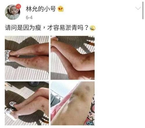 林允行李中疑似成人用品被扒，小号发文否认，网友:逃不过我法眼