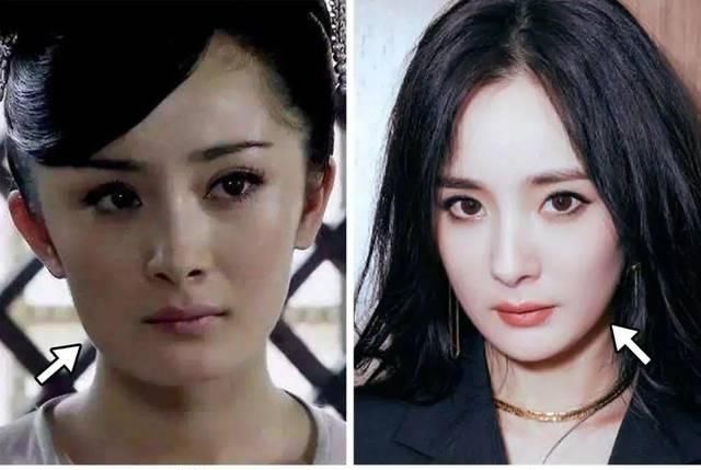 「看起来就」为什么做了整形也没有变好看