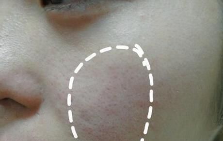 在药店这俩种水，分分钟美白淡斑，就是因为太便宜被很多人忽视!