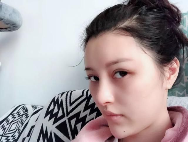隆鼻后,竟让她成为了羡煞旁人的“明星脸”!