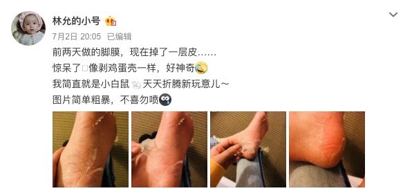 林允回应撕脚皮说了这样的话，这次连粉丝也救不了她