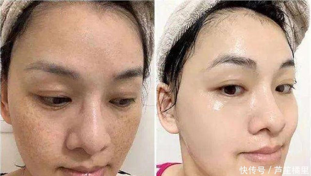  『白净』苹果加它敷脸，15天赶走色斑暗沉，恢复肌肤白净水嫩，效果给力！
