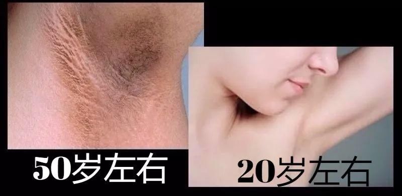 女人身上最需要保养的部位，90%女人竟都忽略了