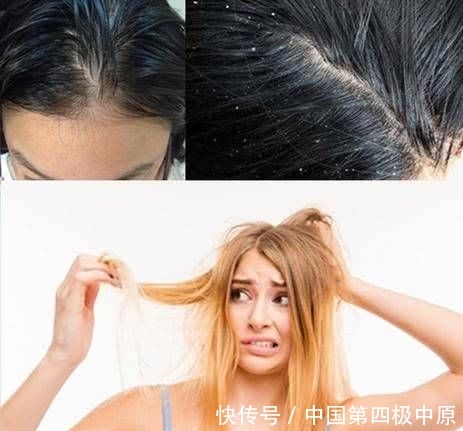 『款洗发』3款容易“踩雷”的洗发水,用后头痒又起头皮屑,没用过真的幸运