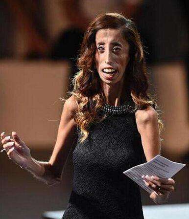 “零脂肪”的患病女孩，身高1米57，体重27公斤