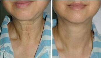 这4个地方最容易暴露女人的年纪!一定要好好保护