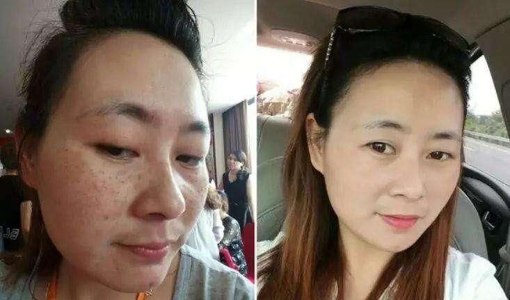  「珍珠粉」维生素E加“它”敷脸，淡斑去皱又美白，一个月皮肤白嫩有弹性