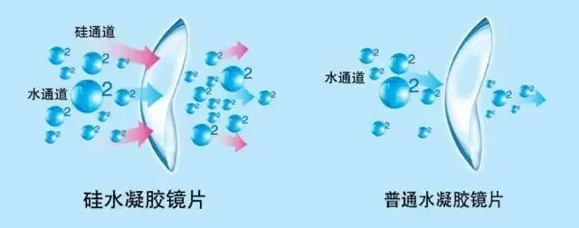 得好@美瞳戴得好,赛过开眼角!