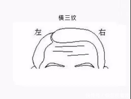 男克妻,女克夫 你头上是否有这条纹?