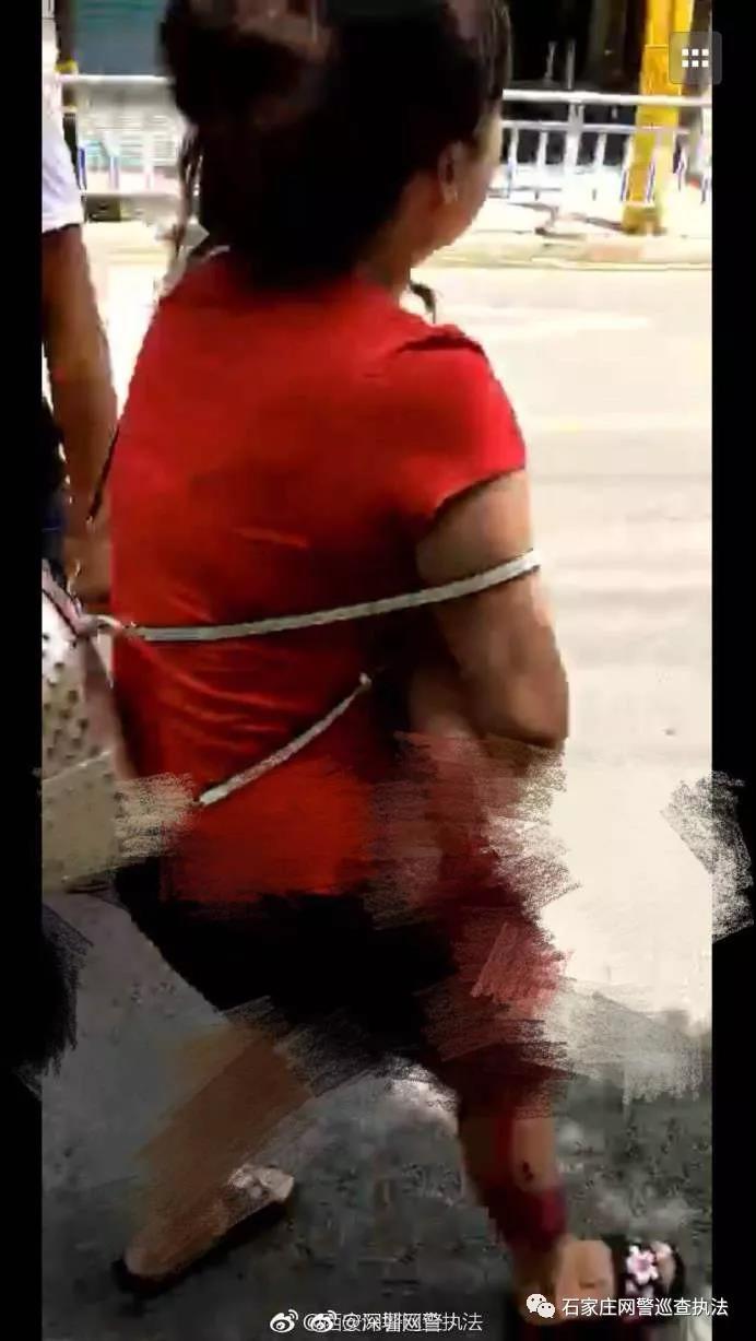 「网警提示」网传一小孩被狗咬断腿系谣言！