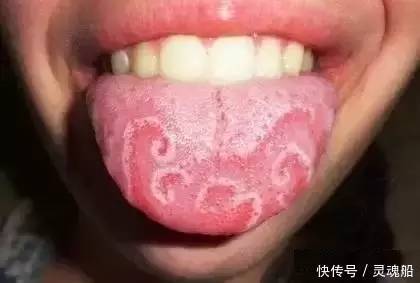 世界最恐怖的基因变异病!你肯定没见过!