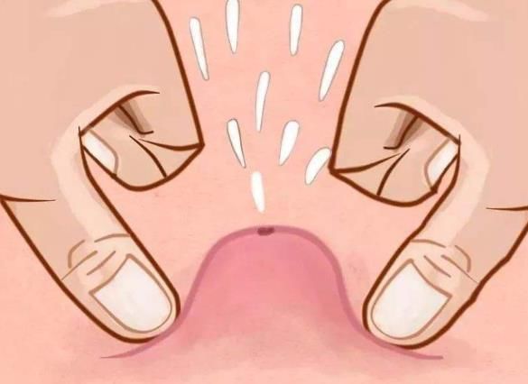 3种表现证明你脸上长螨虫，很多女生用错醋洗脸，难怪没效果