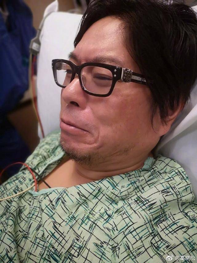 高晓松拔智齿被科普"不会瘦脸" 丁香医生还曾多次怼薛之谦