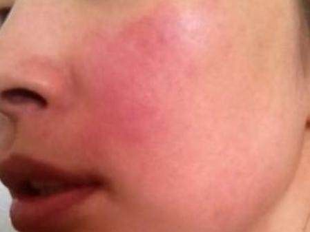  『换季』壹知肤：换季不慌张，关于皮肤屏障那些事你了解多少？