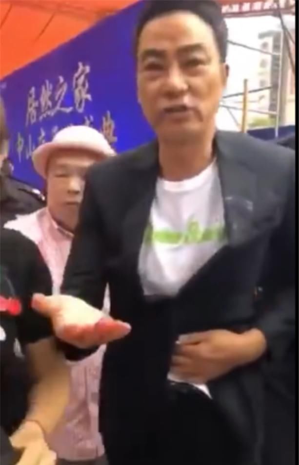 『 经纪公司』将对肇事者追究到底，任达华经纪公司发声明：手术成功