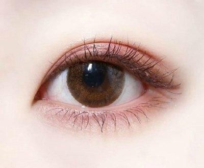  「告别」开眼角帮你告别“眯眯眼”！