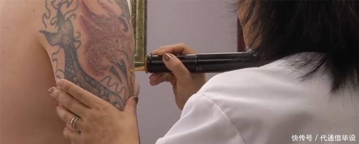 『针头』纹身到底疼不疼用显微镜放大了100倍,看针头刺进皮肤有多疼