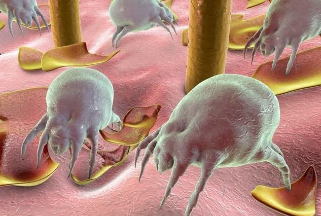 提醒：洗背搓出的你以为是泥儿？很可能是螨虫的痕迹