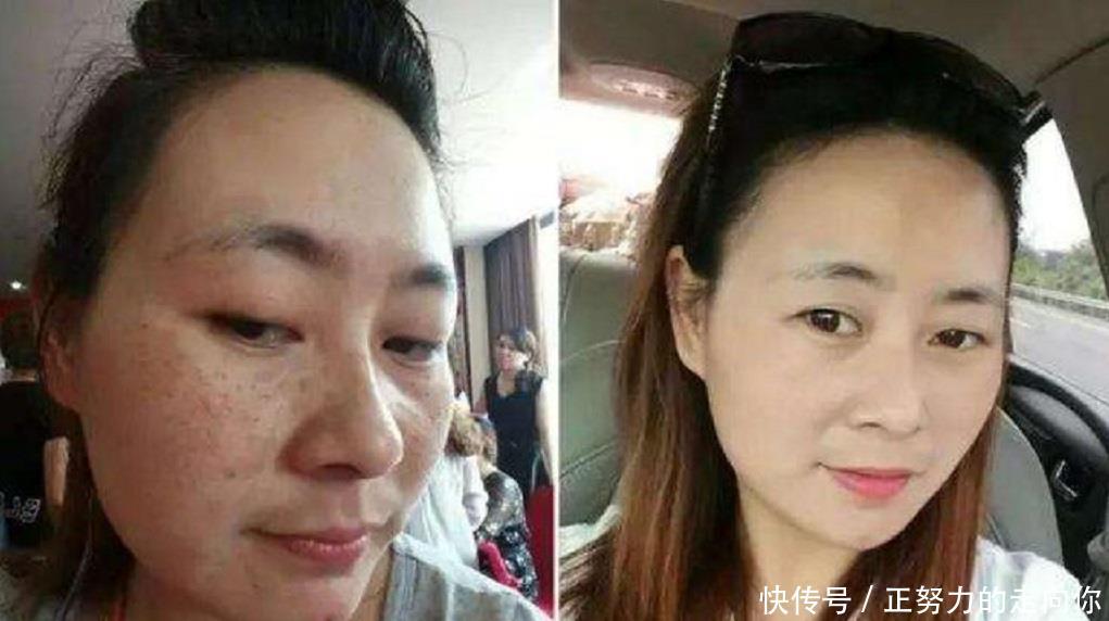  [皮肤]牙膏加“它”敷脸，不出一个月皮肤白嫩光洁，色斑、黑头也变淡了