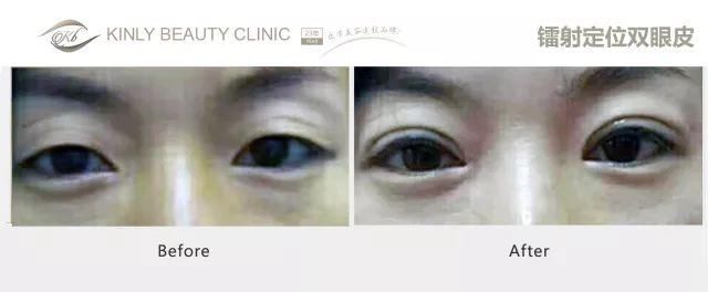 传周迅高圣远分居将要离婚?娱乐圈对女人到底有多残酷?为了戏路更