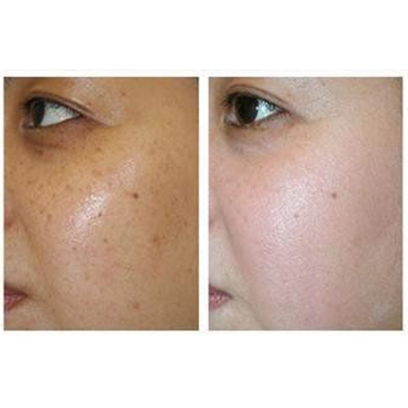 98岁老奶奶偷偷告诉我，农村的便宜药膏，抹一抹眼纹眼袋全不见