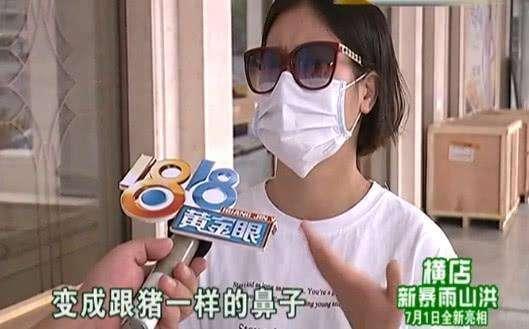 女子花了五万元整容, 结果做成了猪鼻子, 网友: 承包了我一年的笑