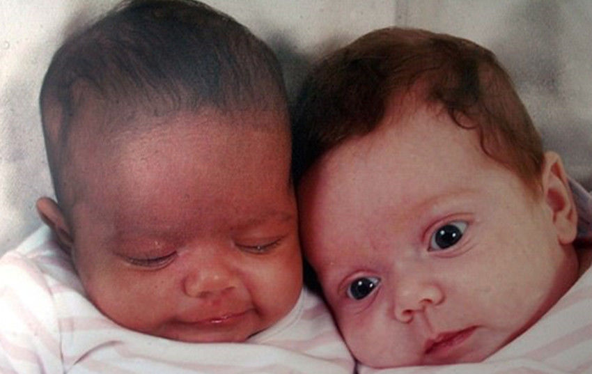 英国双胞胎姐妹肤色一黑一白，上学后老师都不敢相信