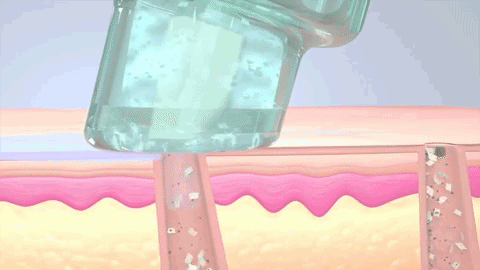 『导致皮肤』皮肤暗沉粗糙?毛孔粗大?那一定是你做错了这一步