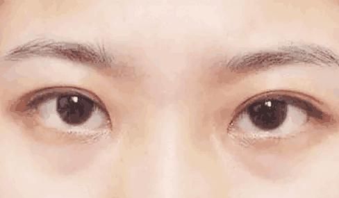 卧蚕和眼袋傻傻分不清楚，错把眼袋当卧蚕的你可长点心吧