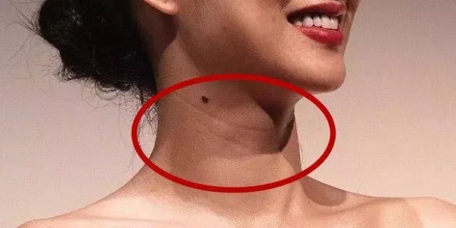 【保养】别管男女,如果脖子出现这种情况,该注意保养啦,别总是不当回事