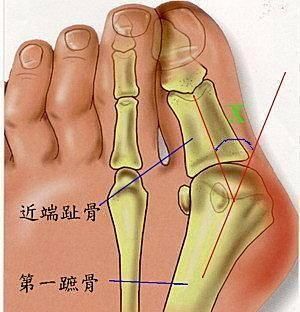  高度：穿高跟鞋别超过这个高度，否则伤腰伤腿伤盆骨！