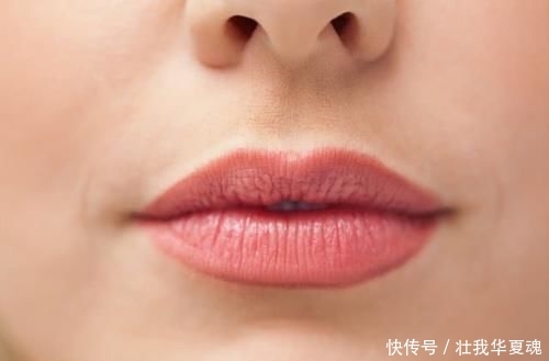  嘴角周围的皮肤：怎样能去掉嘴角两侧的黑东西 三个妙计待领取