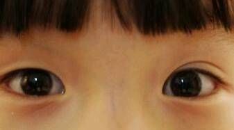  「儿子」儿子单眼皮，可他妈妈怕他的双眼皮，对孩子的双眼皮有特别的暗示吗？