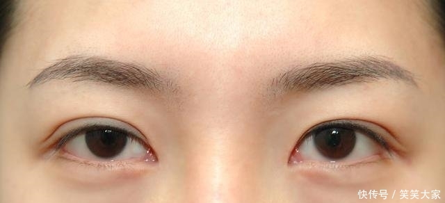 『眼霜』药店有二种“医用眼霜”,对付皱纹眼袋小菜一碟,遗憾是知道的人太少