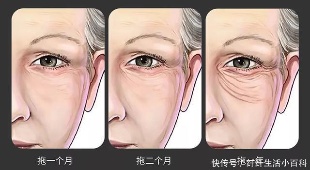  【百科】瘦百科18小黑盒：口罩也遮不住的眼纹该拿它怎么办？