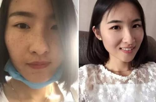 55岁大妈，每天拿"它"擦脸，一夜美白又补水，三天斑点