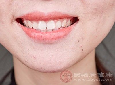  「症状」嘴唇干怎么办 多补充维生素可以缓解这个症状