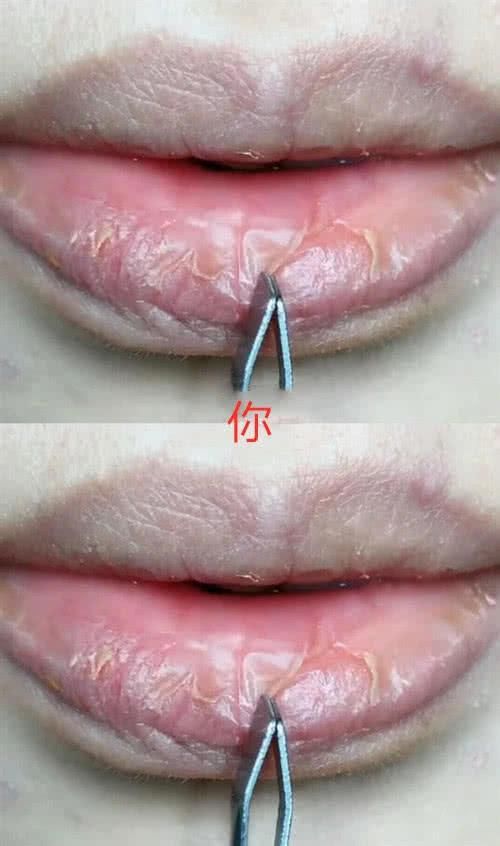  嘴唇|同样是“嘴唇特写”，别人VS你，一个美若天仙，一个像夜叉巡街