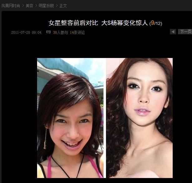 女孩整容太美遭暴打 杨颖杨幂会不会遭追杀呢?