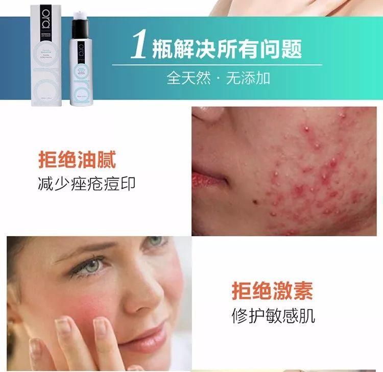 新西兰天然野生黑蕨修护精华，超强补水无刺激，敏感肌肤和孕产妇