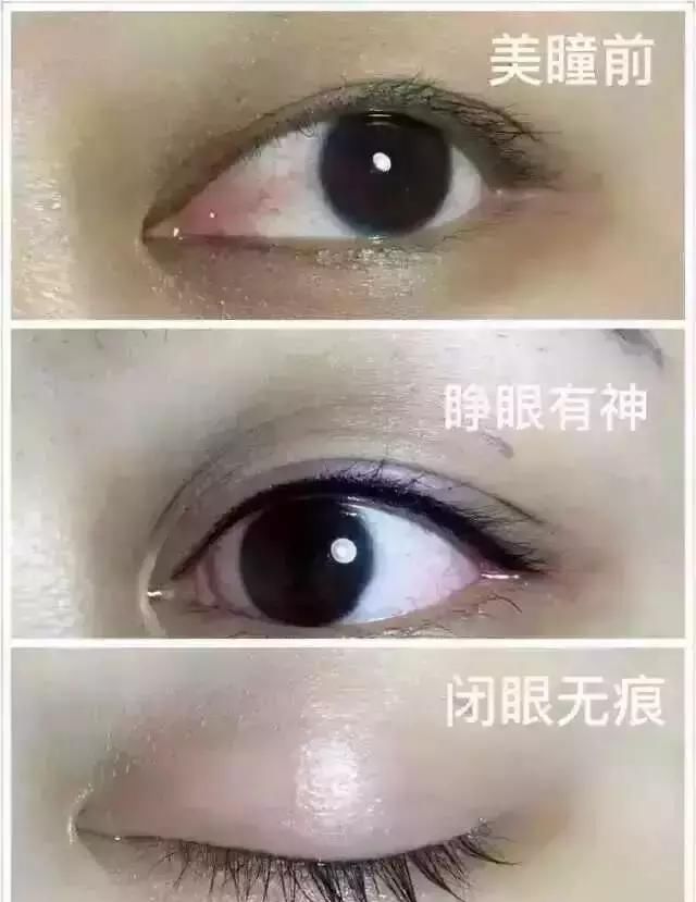 【眼睛有神】梵娅半永久:她画了三年眼线,眼睛老了十岁
