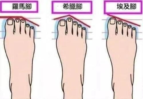  「罗马脚」女人“脚型”一般分为这3种！如若你是第1种，穿凉鞋很好看！