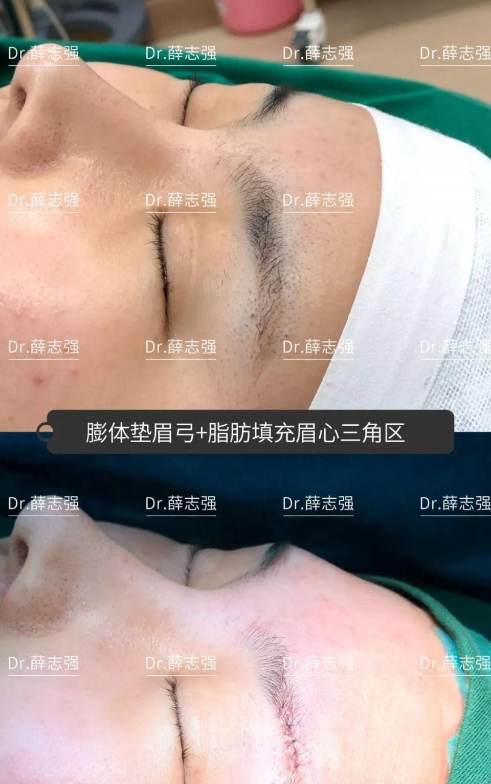  『后12小时内』假期术后注意事项大全！